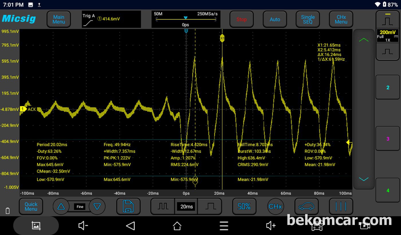 Sample wave form, human body with signal probe|베콤카 (bekomcar.com)