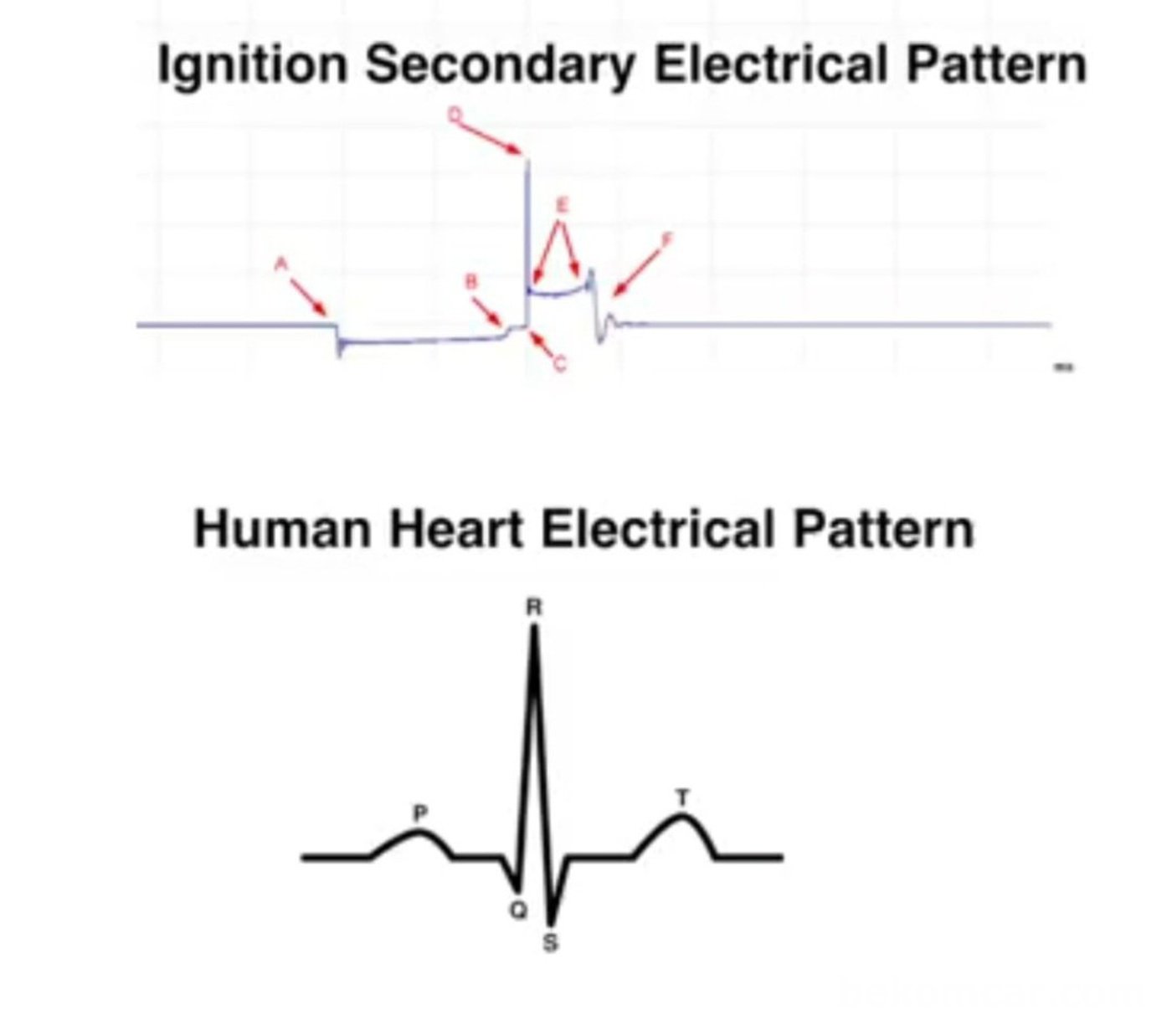 사람심장의 EKG 파형과 차량의 이그니션 파형의 ㅂ교모습이다. Courtesy of DeadOnDiagnostics|بيكومكار (bekomcar)
