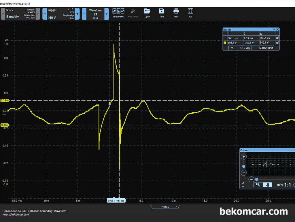 RPM 헌팅현상 과 사제캐퍼시터 와 상간관계, 혼다 시빅 8세대 2.0 사례|bekomcar.com