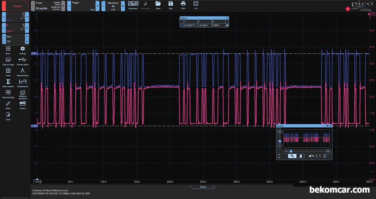 F10 528i CAN High & Low 캔통신 NO ACK 파형, BMW F10 528i ABS 모듈고장 점검 과정이다. NO ACK 의 전형적인 캔 통신 파형이다.|bekomcar.com