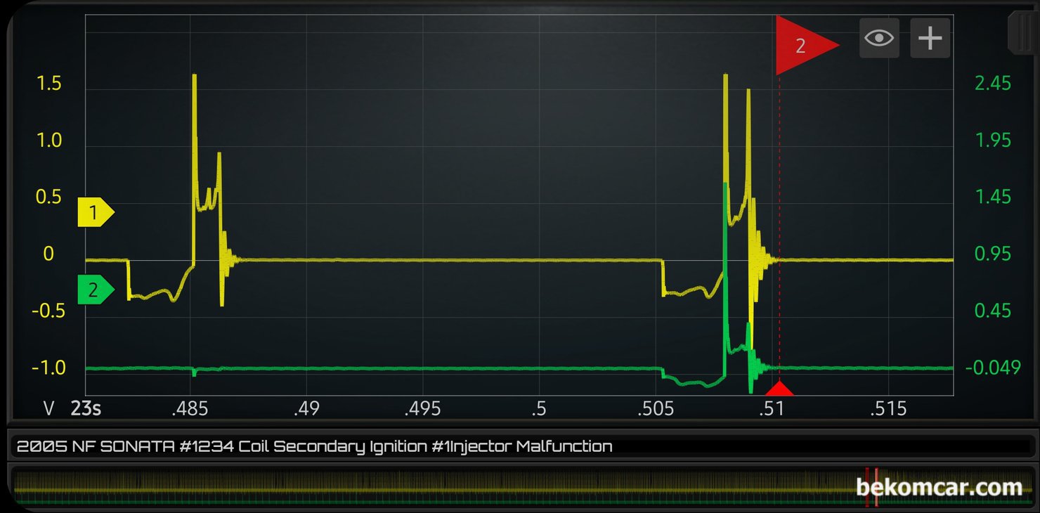 점화파형 과 인젝터 작동 & 실린더내 희박 상태등 진단 기록, 인젝터 작동중 그리고 인젝터 고장 인경우의 비교 점홮형이다. 빨간 깃발 부분의 점화파형이 인젝터 고장인 경우의 파형이다. 실린더 내부가 상당히 희박한 상태이거나 인젝터 고장인 경우에 흔하게 측정되는 파형이다. 점화파형은 엔진상태 상당부분을 알 수 있는 정보를 제공한다.|베콤카 차량정밀진단