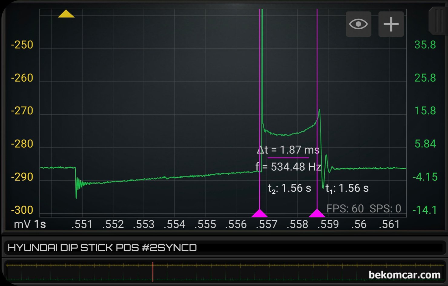 XG 점화파형 과 피스톤링 누설 파형측정 기록, 베콤카 정비인 워크샵과정, 점호코일 작동시간 과 점화 플러그 작동구간 (Burn time) 은 약 1.87ms 정도인데 XG 차량 출시 당시의 PFI 방식 인젝터 시스템에서는 정상적인 작동 시간이다. 플라즈마 포인트도 좋고, 실린더내 공연비나 밸브 상태도 좋다. 점화코일 상태도 좋게 진단 된다. 전체적으로 점화 시스템은 정상 작동중이다.|ベコムカー (bekomcar)